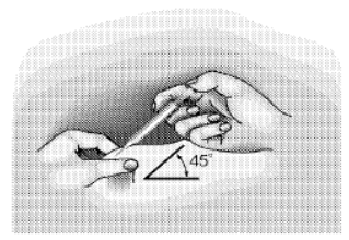 OCLADRA 2 MG/ML ENJEKSIYONLUK COZELTI ICEREN 1 FLAKON görseli 3