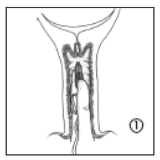 PROPESS OVUL 10 MG 1 OVUL görseli 2