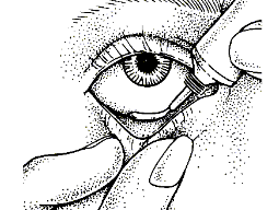 CORTIMYCINE 5 GR POMAD görseli 2