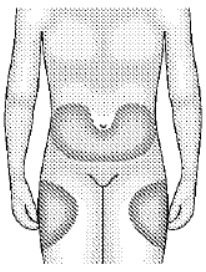OCLADRA 2 MG/ML ENJEKSIYONLUK COZELTI ICEREN 1 FLAKON görseli 2