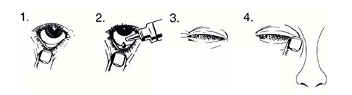 COMBIGAN STERIL GOZ DAMLASI 5 ML görseli 2
