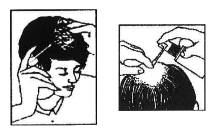 ANDROVIUM %2 TOPIKAL COZELTI görseli 2