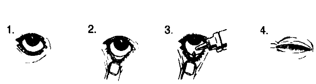 ALPHAGAN-P %0,15 5 ML görseli 2