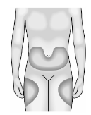 ARANESP 50 MCG 4 KULLANIMA HAZIR DOLU ENJEKTOR ICINDE ENJ. COZELTI görseli 3