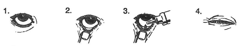 REFRESH LIQUIGEL LUBRICANT 15 ML GOZ DAMLASI görseli 2
