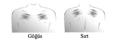 TRANSTEC 52.5 mcg/saat Transdermal Flaster görseli 2