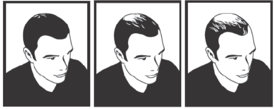 ANDROVIUM %2 TOPIKAL KOPUK (90 G) görseli 2