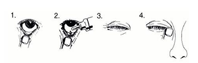 RIMOSOPT 2 MG/ML + 5 MG/ML GOZ DAMLASI, COZELTI görseli 2