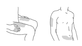 STELARA 45 MG ENJEKSIYONLUK COZELTI ICEREN KULLANIMA HAZIR ENJEKTOR görseli 3