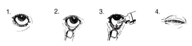 LUMIGAN 0,3 MG 3 ML GOZ DAMLASI görseli 2