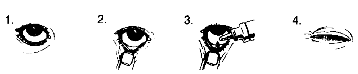 ACULAR LS STERIL GOZ DAMLASI %0,4 5 ML görseli 2