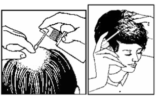 MINOXIL %2 DERI SPREYI görseli 2