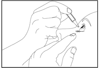 TIMOCOPT Göz Damlası görseli 3