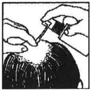 ANDROVIUM %5 TOPIKAL COZELTI görseli 2