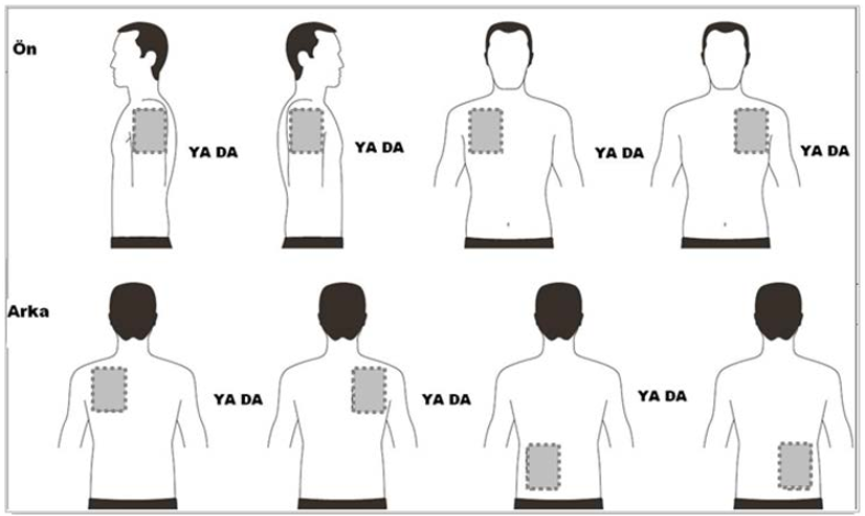 EXELON PATCH 13,3 MG/24 SAAT TRANSDERMAL FLASTER görseli 2